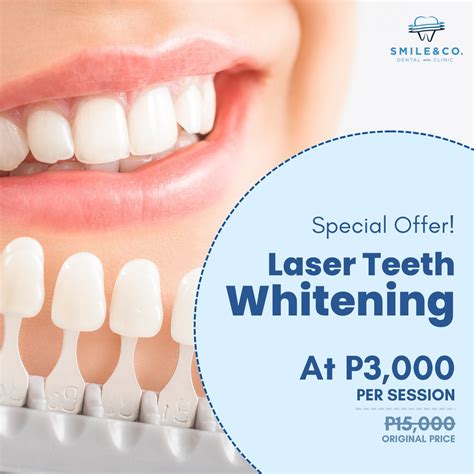 teethtalk dental clinic pasig photos|Smile & Co. Dental Clinic .